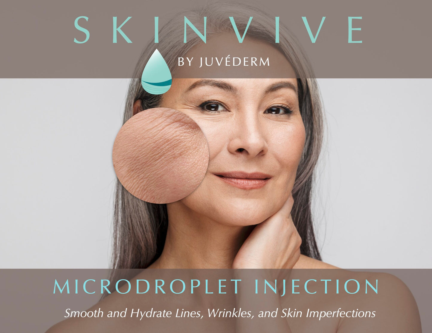 Skinvive Microdroplet Injectable by Juvéderm
