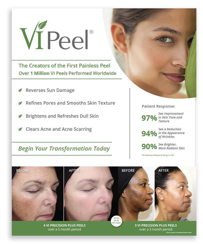 VI Peel Package of 3