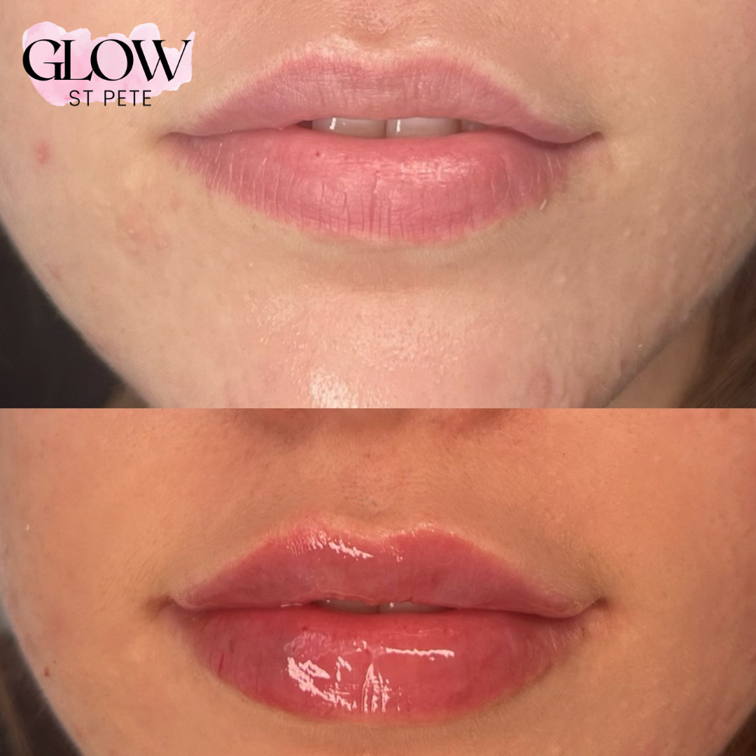 Save $150 On Lip Blushing: Black Friday