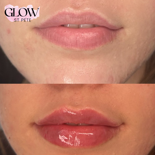 Save $150 On Lip Blushing: Black Friday